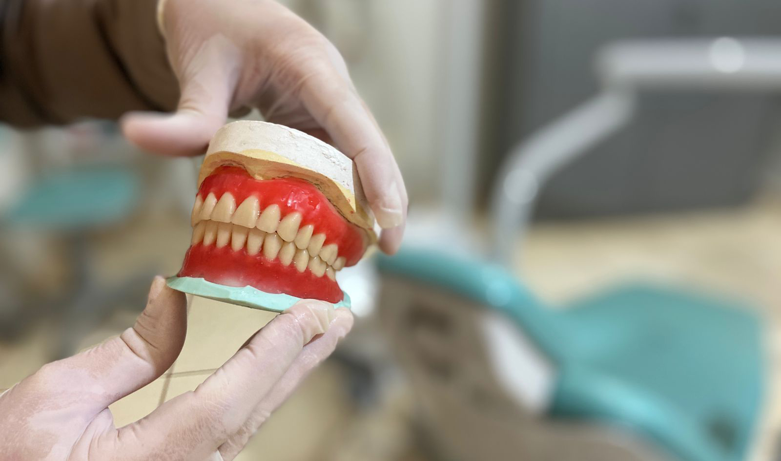 MUTIRÃO DE PRÓTESES DENTÁRIAS: SAIBA COMO FUNCIONA